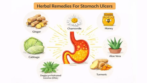 Herbal Remedies For Stomach Ulcers.png