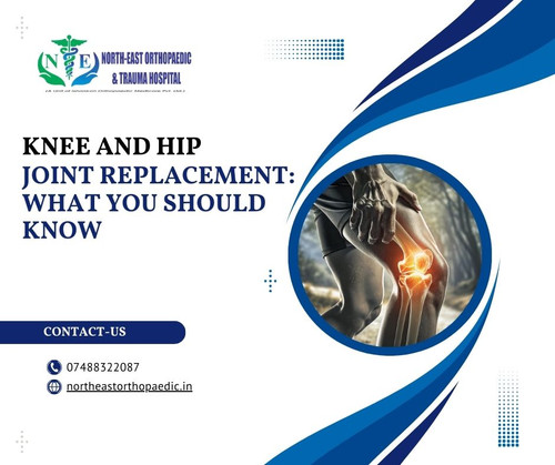 Knee and Hip Joint Replacement: What You Should Know.jpg