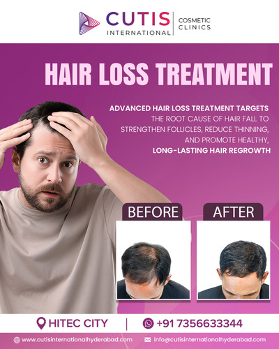 Why Early Hair Loss Treatment Prevents Severe Thinning?.jpg