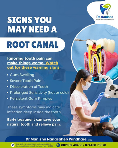 #Root Canal Treatment in Chinchwad...jpg
