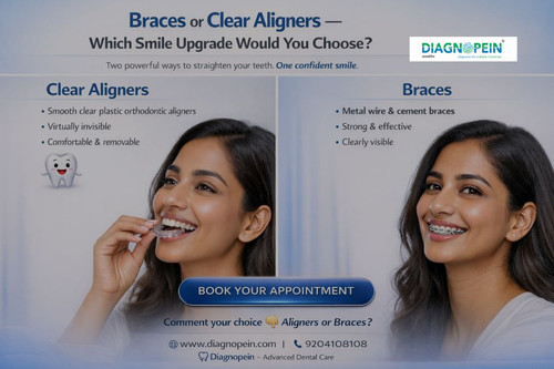 Braces and Clear Aligners.jpg