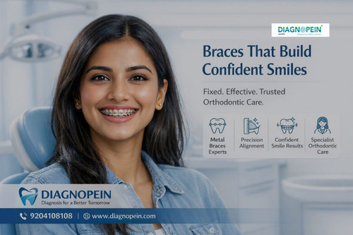 Dental Braces (9).jpg