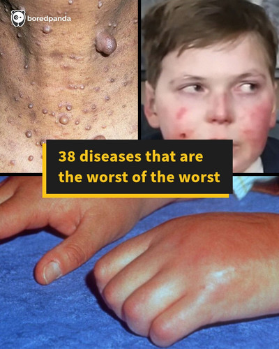 worst diseases.jpg