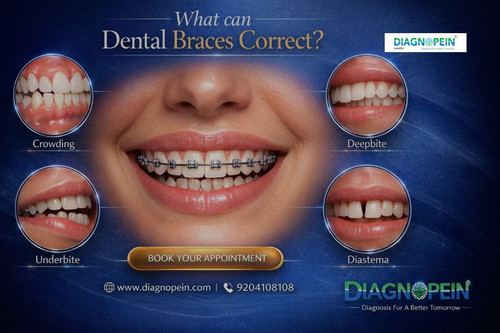 Dental Braces (6).jpg