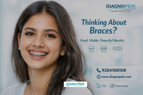 Dental Braces (8).jpg