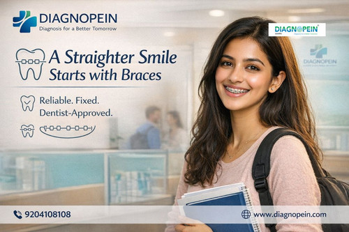 Dental Braces (11).jpg