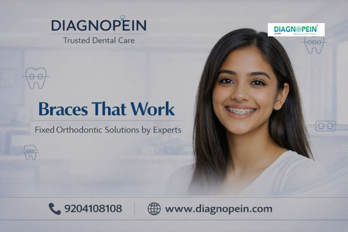 Dental Braces (13).jpg