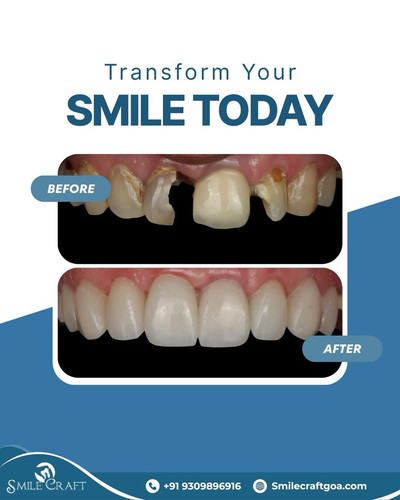 A smile transformation isn’t just about teeth it’s about confidence. Let Smile Craft help you sm.jpg