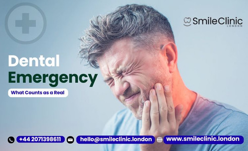 What Counts as a Real Dental Emergency (And When You Shouldn’t Wait It Out).jpg