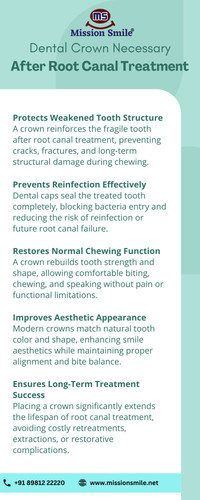 Dental Crown Necessary After Root Canal Treatment.jpg