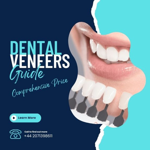 A Comprehensive Price Guide for the Dental Veneers.jpg
