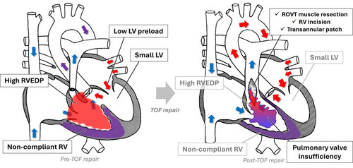 G Rn7P1WAAAhima?format=jpg.jpg