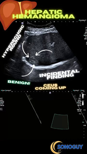 IHZlr5l1z 5Z34kD.jpg