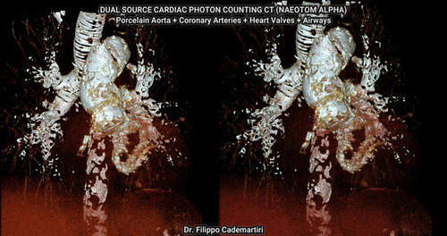 IU kgTHi6Hm3IU I.jpg