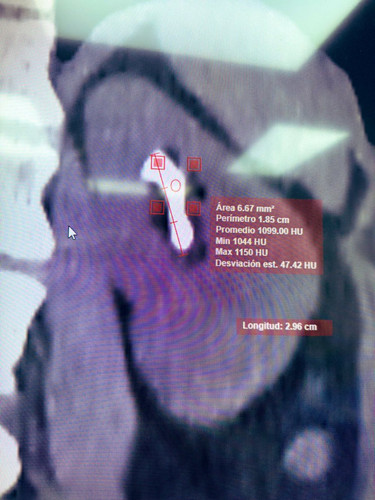 G POyRcXAAIOpSy?format=jpg.jpg