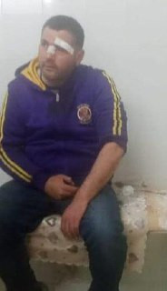 مليشيات المستوطنين تهاجم الشاب شرحبيل جمال مليطات من بلدة بيت فوريك شرق نابلس قرب بلدة بديا غرب سلفيت وتقوم بسرقة مركبته....