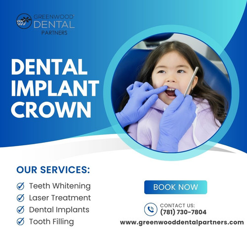 Dental Implant Crown – Natural Looking Smile Restoration.jpg