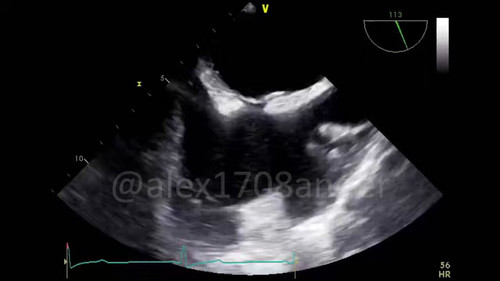 W88Cusgz m qdyho.jpg