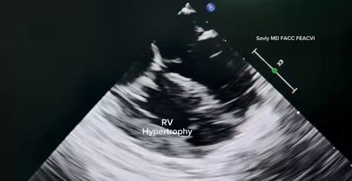 yV7D miwI640Et V.jpg