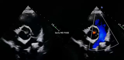 a onzf40KjBrw0T .jpg