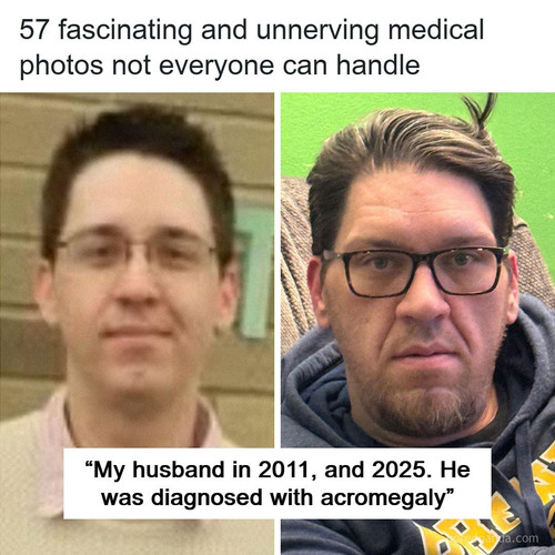 creepy medical pics.jpg