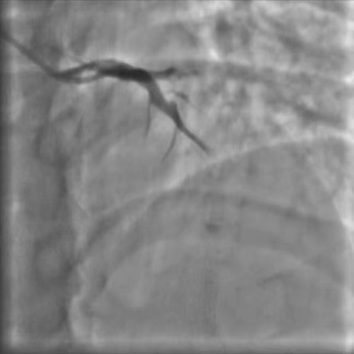 hfX7GGV3th q4yTS.jpg