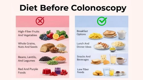Foods Allowed On Low Fiber Diet Before Colonoscopy.png
