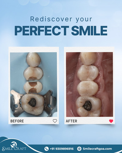 Perfect Smile.jpg