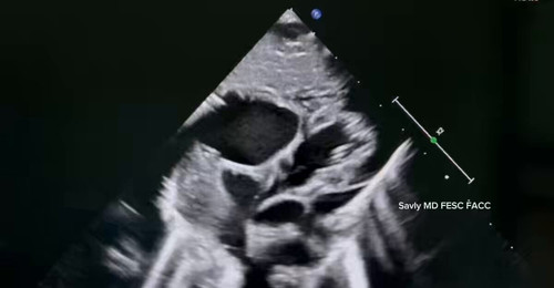 FRFB56k Z8plZQIY.jpg