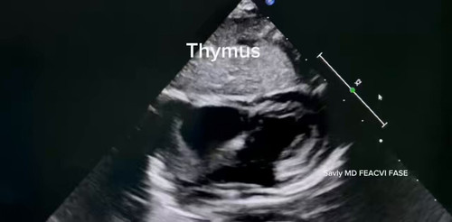TfcXyVT8rrOGvksb.jpg