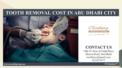 TOOTH REMOVAL COST IN ABU DHABI CITY.jpg