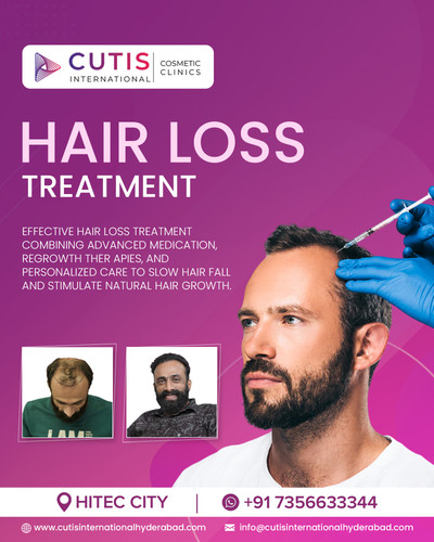 What Is Hair Loss Treatment and How It Helps Regain Confidence?.jpg