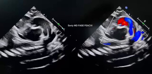 TzzrWHFd EdoRtfQ.jpg