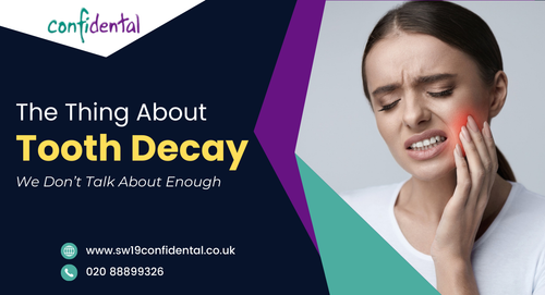 The-Thing-About-Tooth-Decay-We-Dont-Talk-About-Enough.png