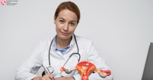 Adenomyosis Treatment 5.png