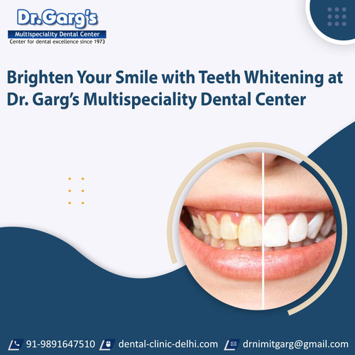 Brighten Your Smile with Teeth Whitening at Dr. Garg’s Multispeciality Dental Center.jpg
