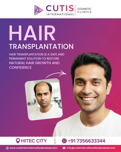 Best Hair Transplantation Clinic in Hyderabad for Natural Results.jpg