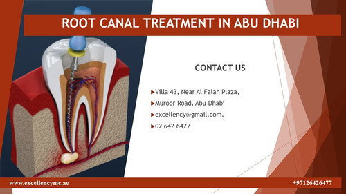 ROOT CANAL TREATMENT IN ABU DHABI.jpg