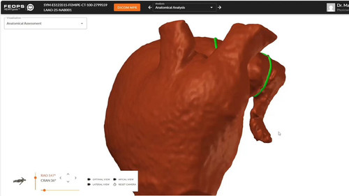 2oRLpB z1mehUY3w.jpg