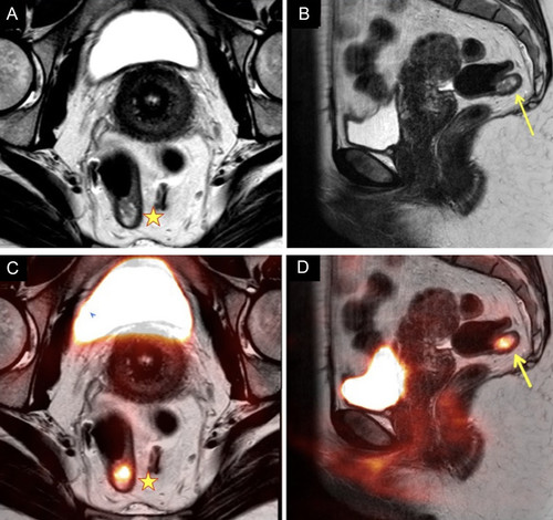 G G1bdnXIAA0B 6?format=jpg.jpg