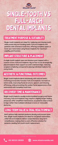 Single Tooth vs Full Arch Dental Implants in Kolkata.jpg