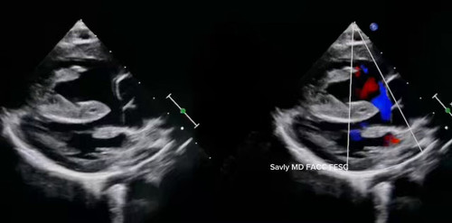 GgmhcbKKafXcJbY .jpg