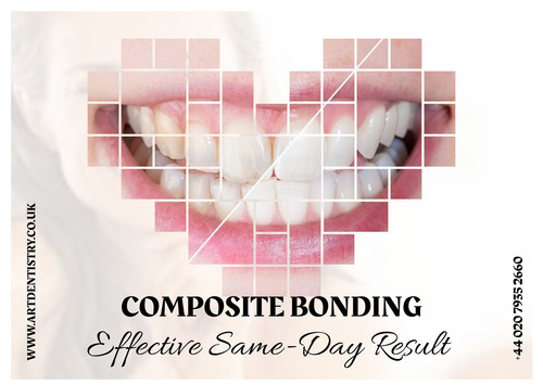 Get the Effective Same Day Result with Composite Bonding.jpg