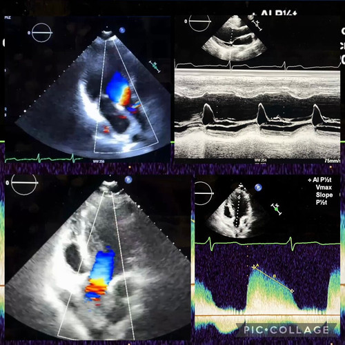 P2 7DW68hMyPqUzW.jpg