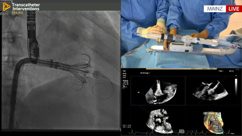 mutynhpJyU X10QU.jpg