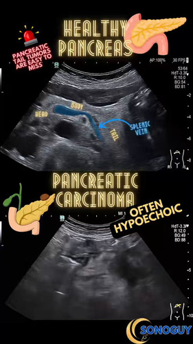 Ycw3LulHJHJp3G k.jpg