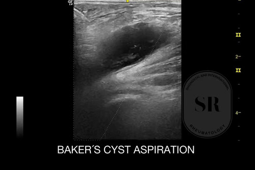 5KU2nXV0 6aLwcng.jpg