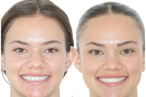 Who is the top rated orthodontist in Castle Rock?.png