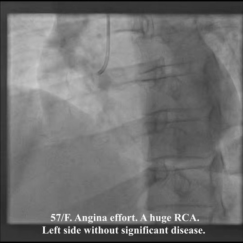 w6OpDVs bidEvYb4.jpg