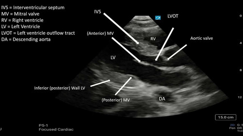 PZVTglTR5qCl X92.jpg